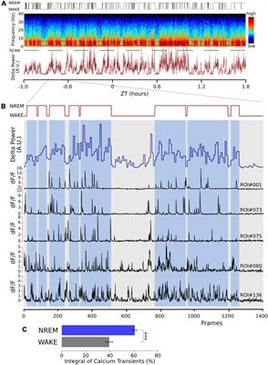 Dihydropyridine calcium blockers do not interfere with non-rapid eye movement sleep